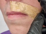 Депиляция зон лица / Щеглово